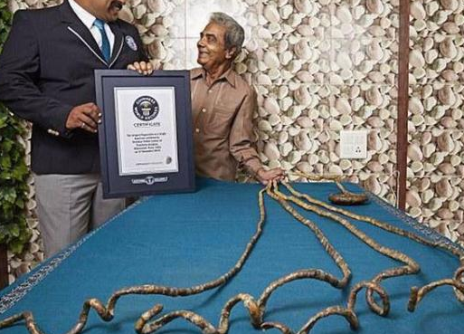 世界上最长的指甲