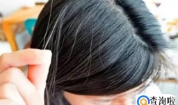 白头发为什么不能拔