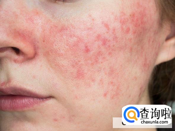 怎么看护肤品过不过敏