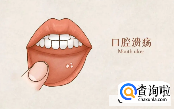 意可贴的效果怎么样?