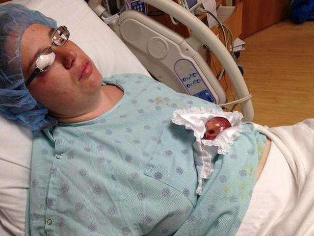 世界上最小的婴儿