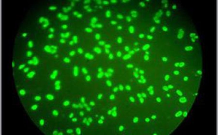 肺炎支原体抗体阳性是什么意思