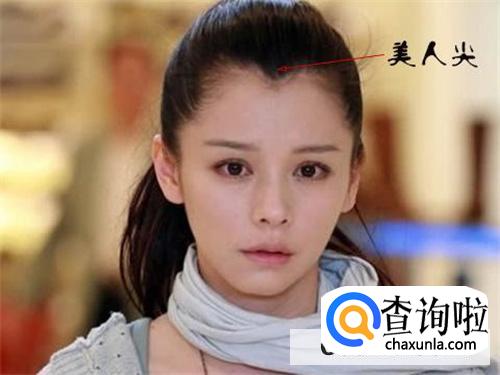 美人尖是什么