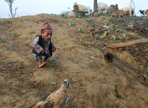 世界上最矮的人