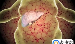 每天喝一杯牛奶，对血脂有什么影响？建议大家早了解