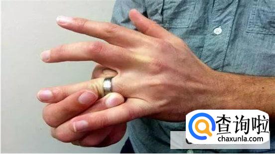 戒指卡手了怎么办