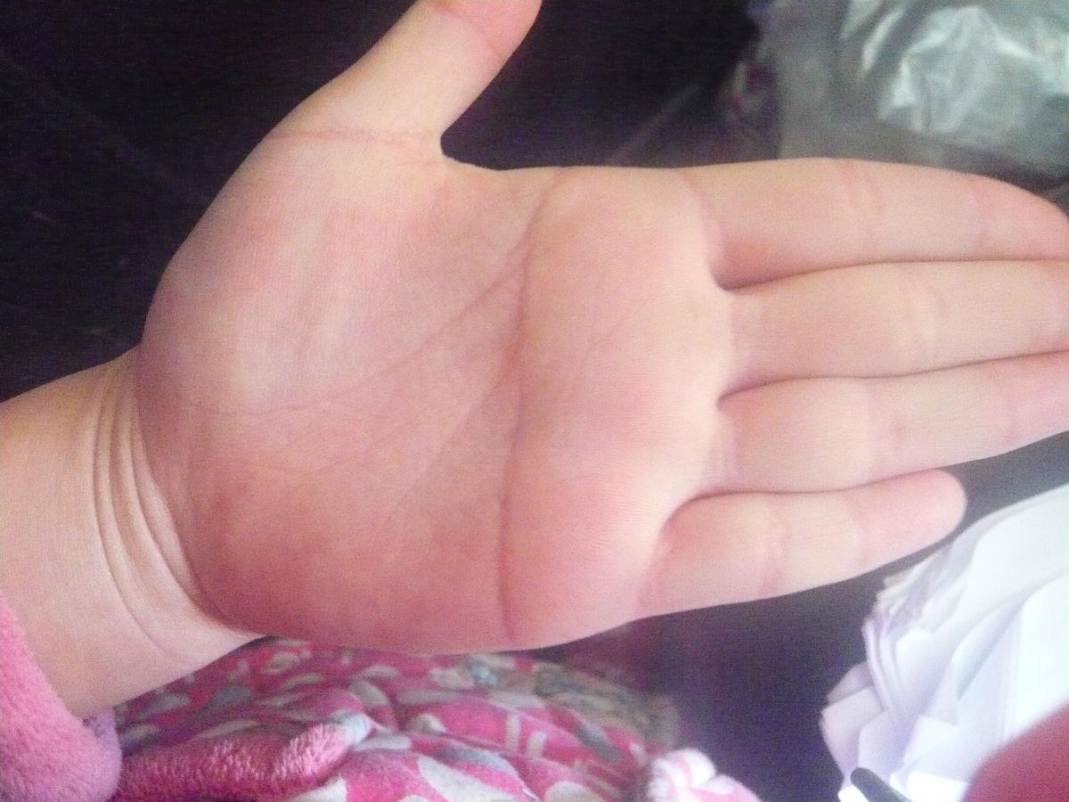 断掌是什么意思