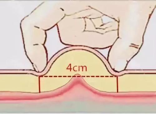 脂肪是大分子物质吗