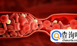怎么知道“血管堵没堵” 教您几个方法 轻松解决 很实用