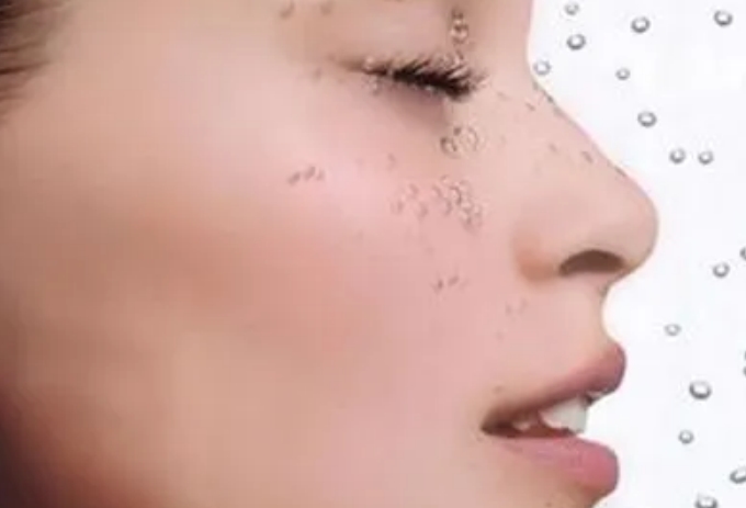 如何治疗干燥综合症