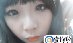 娃娃脸和婴儿肥有什么区别