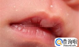 婴儿嘴唇起白点怎么办3种处理方法让妈妈们别担心