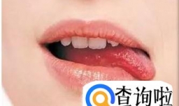 冬季嘴唇总是起皮怎么办