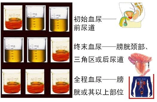 尿血怎么回事