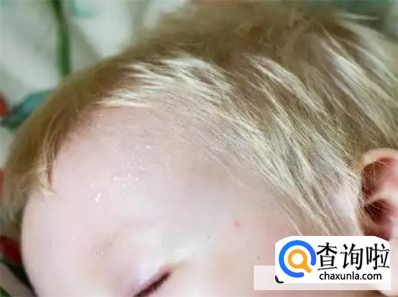 孩子9岁会出现睡觉头上疯狂的冒汗吗