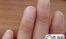 指甲有竖纹什么原因