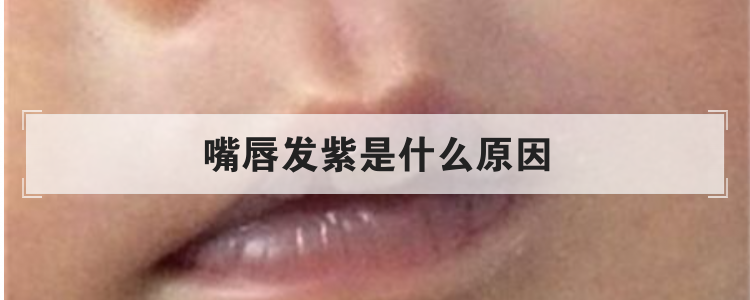 嘴唇发紫是什么原因