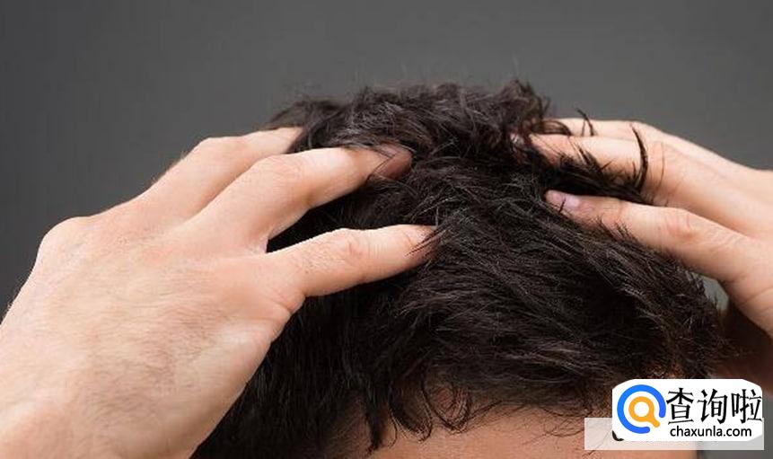头皮痒越抓越痒怎么回事