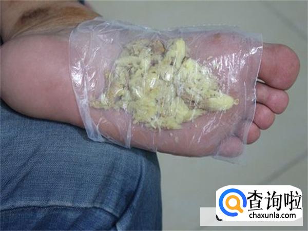 婴儿流鼻涕用姜敷脚心有没有用