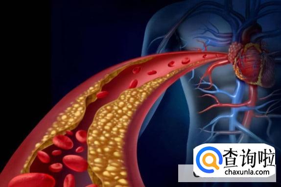 瘦人不会高血脂吗