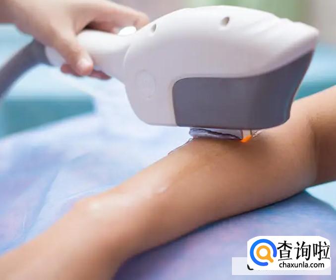 脱毛会有影响吗