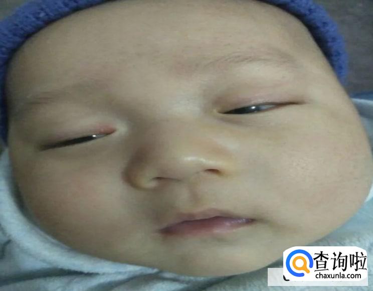 为什么有人睡觉眼睛是半睁的