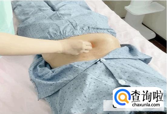 怎样能促进肠胃蠕动