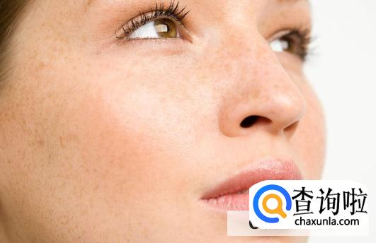 才20岁就有雀斑怎么办