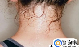 女孩子11岁睡觉经常出汗吗