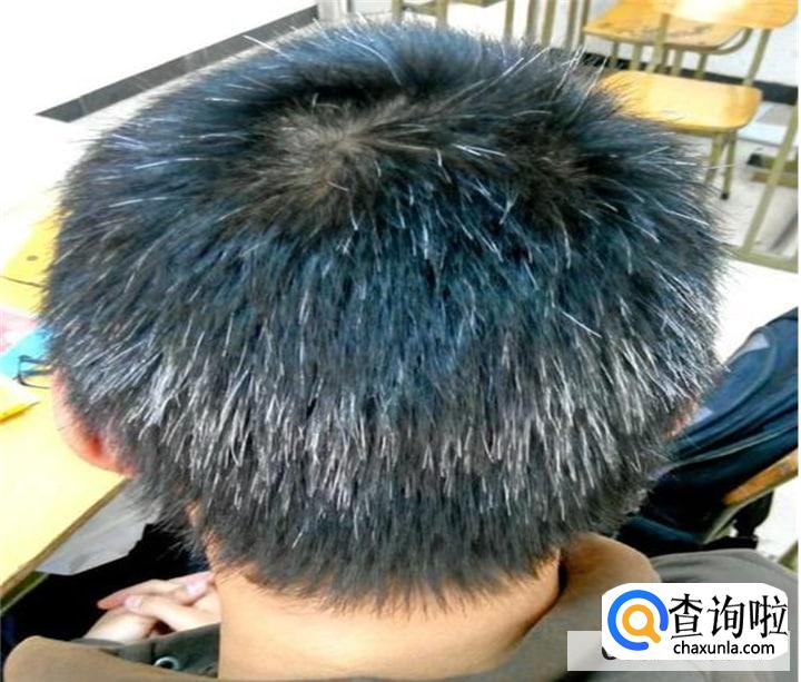 治疗白发的秘方