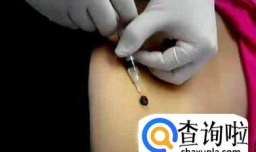 给大家教一个祛痣、取痣的方法 如何不留疤？