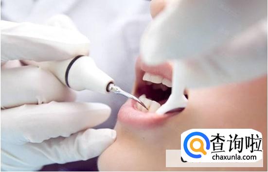 为什么牙医总让我洗牙