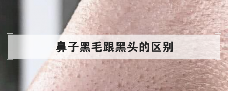鼻子黑毛跟黑头的区别