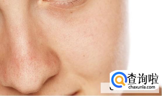 夏天皮肤出油怎么办