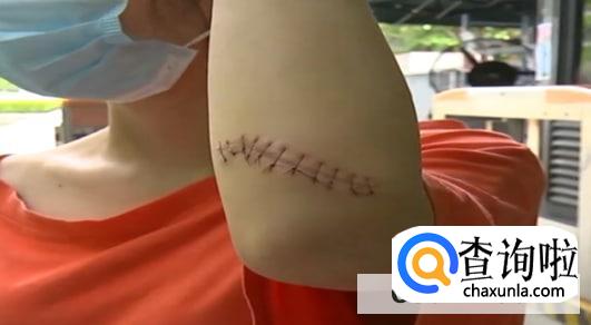 日常处理小伤口的正确步骤