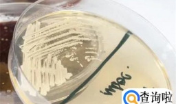 霉菌真菌念珠菌是一样的吗