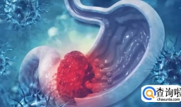 胃癌的出现不痒不痛？如果吃完饭后，有5种异常，或要及时检查