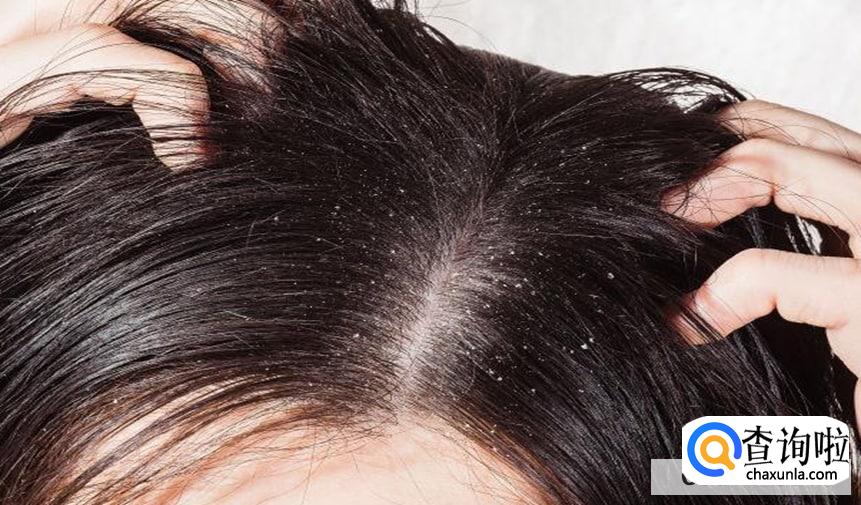 头皮痒越抓越痒怎么回事