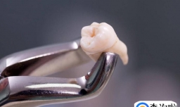 智齿牙龈发炎肿痛该怎么办