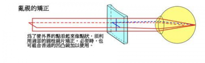 戴隐形眼镜可以矫正视力吗