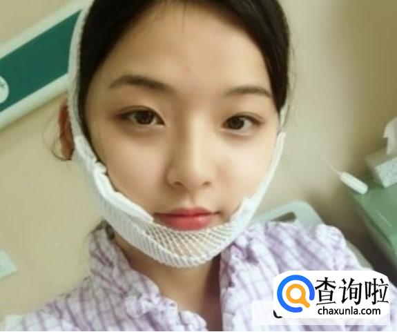 下颌角手术头套带多久