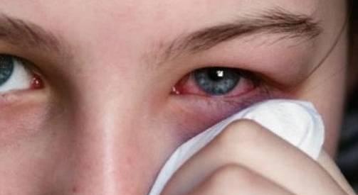 用手揉眼为什么不好