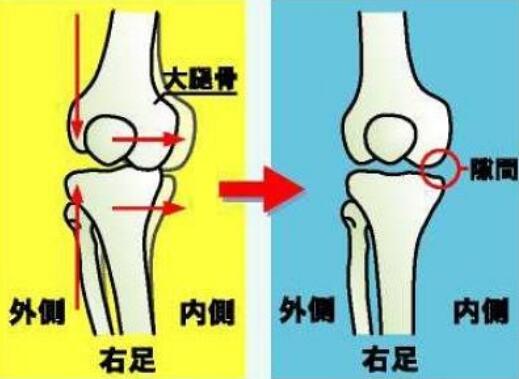 改善o型腿的动作