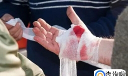 血小板压积偏高是什么原因