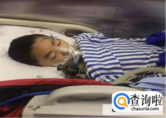 小儿煤气中毒的急救措施?