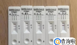 阳后一直咳嗽要拍CT吗