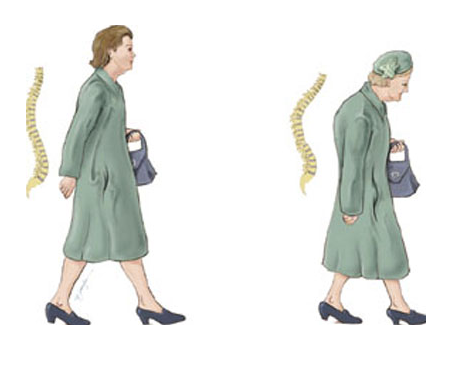 bmi指数低于18危害