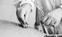 针灸的疗效有哪些？