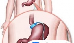 胃腩和肚腩有什么区别