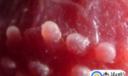 龟头炎是性病吗 龟头炎可以自愈吗